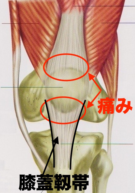熊本-ジャンパー膝-整体