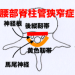 熊本-腰部脊柱管狭窄症-整体